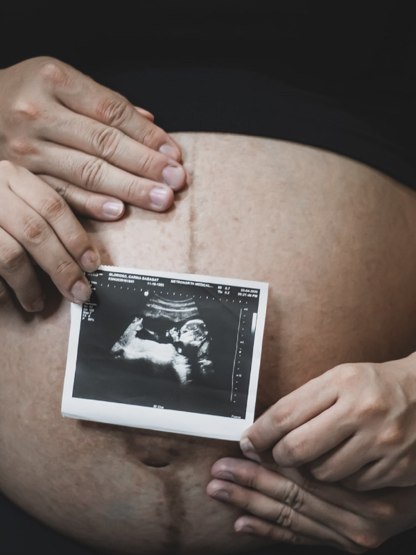 pregnant woman holding a ultrasound picture